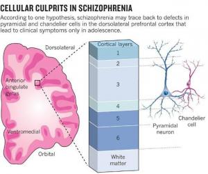 Schizophrenia: The making of a troubled mind