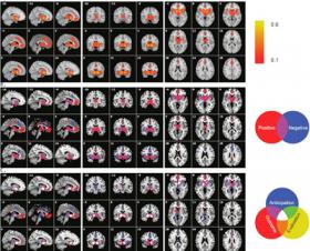 Neurosci Biobehav R.:“奖励决策行为脑成像的元分析”研究取得进展