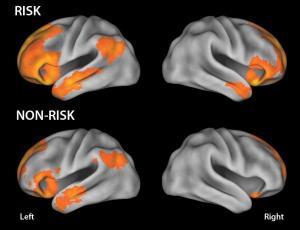 Autism Study Reveals How Genetic Changes Rewire the Brain