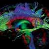 神经科学：理解与使用大脑